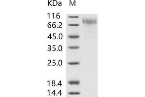 Western Blotting (WB) image for Respiratory Syncytial Virus Glycoprotein (RSV G) protein (His tag) (ABIN7198762) (Respiratory Syncytial Virus Glycoprotein (RSV G) protein (His tag))