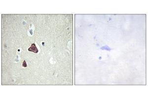 Immunohistochemistry (IHC) image for anti-Adenylate Cyclase 8 (Brain) (ADCY8) (Internal Region) antibody (ABIN1850180) (ADCY8 antibody  (Internal Region))