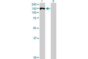 Western Blot analysis of KIT expression in transfected 293T cell line by KIT MaxPab polyclonal antibody. (KIT antibody  (AA 1-976))