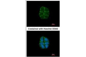 ICC/IF Image Immunofluorescence analysis of paraformaldehyde-fixed A431, using Desmoglein 2, antibody at 1:500 dilution. (Desmoglein 2 antibody  (N-Term))