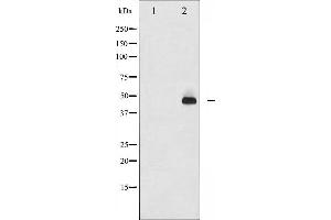 Western blot analysis of c-Jun phosphorylation expression in UV treated HeLa whole cell lysates,The lane on the left is treated with the antigen-specific peptide.