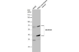 WB Image SEC61A1 antibody detects SEC61A1 protein by western blot analysis. (SEC61A1 antibody  (C-Term))