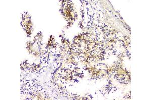 IHC analysis of SCN4B using anti-SCN4B antibody (ABIN6719653).