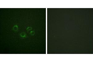 Peptide - +Western blot analysis of extracts from NIH/3T3 cells, using EPHA2/3/4 (Ab-588/596) antibody. (EPHA2/3/4 antibody  (Tyr588))