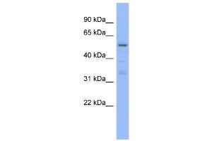WB Suggested Anti-TRIM5  Antibody Titration: 0.