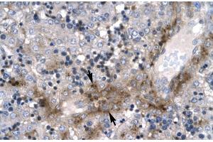 Human Liver; Rabbit Anti-ZNF365 Antibody. (ZNF365 antibody  (N-Term))