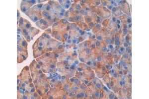 Immunohistochemistry (IHC) image for anti-Tumor Necrosis Factor alpha (TNF alpha) (AA 57-235) antibody (ABIN7445246)