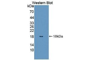 Detection of Recombinant UBA52, Human using Polyclonal Antibody to Ubiquitin A 52 Residue Ribosomal Protein Fusion Product 1 (UBA52) (UBA52 antibody  (AA 1-128))