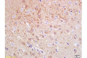 Formalin-fixed and paraffin embedded rat brain labeled with Anti-Synphilin-1 Polyclonal Antibody, Unconjugated (ABIN736163) at 1:200 followed by conjugation to the secondary antibody and DAB staining. (SNCAIP antibody  (AA 51-150))