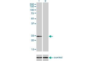 Western blot analysis of AK1 over-expressed 293 cell line, cotransfected with AK1 Validated Chimera RNAi (Lane 2) or non-transfected control (Lane 1). (Adenylate Kinase 1 antibody  (AA 1-194))