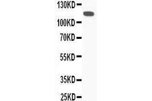 Western Blotting (WB) image for anti-Complement Component 5 (C5) (AA 1-18), (N-Term) antibody (ABIN3044294) (C5 antibody  (N-Term))