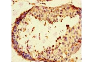 Immunohistochemistry of paraffin-embedded human testis tissue using ABIN7169195 at dilution of 1:100 (TBK1 antibody  (AA 364-585))