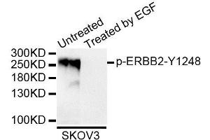 Western blot analysis of extracts of SKOV3 cell line, using Phospho-ERBB2-Y1248 antibody (ABIN5995620). (ErbB2/Her2 antibody  (pTyr1248))