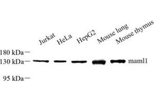 Western blot analysis of maml1 (ABIN7074560) at dilution of 1: 500 (MAML1 antibody)