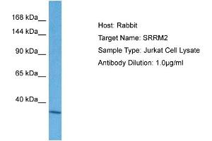 Host: Rabbit Target Name: SRRM2 Sample Tissue: Human Jurkat Whole Cell Antibody Dilution: 1ug/ml (SRRM2 antibody  (C-Term))