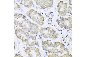 Immunohistochemistry of paraffin-embedded human stomach using L2HGDH antibody (ABIN5975242) at dilution of 1/100 (40x lens). (L2HGDH antibody)