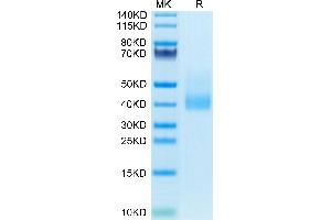 Human CLEC10A on Tris-Bis PAGE under reduced condition. (CLEC10A Protein (AA 61-316) (His tag))