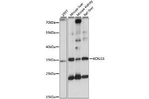 Western blot analysis of extracts of various cell lines, using KCNJ15 antibody. (KCNJ15 antibody)