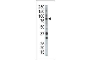 Image no. 1 for anti-BMX Non-Receptor Tyrosine Kinase (BMX) (Middle Region) antibody (ABIN359973) (BMX antibody  (Middle Region))