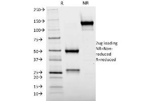 SDS-PAGE (SDS) image for anti-Cytochrome P450, Family 2, Subfamily E, Polypeptide 1 (CYP2E1) (C-Term) antibody (ABIN6939224)