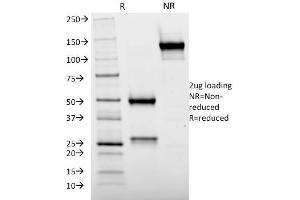 SDS-PAGE Analysis Purified Cytochrome p450 Mouse Monoclonal Antibody (M12P4H2). (CYP2E1 antibody  (C-Term))