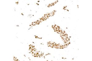 Immunocytochemistry (ICC) image for anti-Androgen Receptor (AR) (AA 1-50) antibody (ABIN7795785) (Recombinant Androgen Receptor antibody  (AA 1-50))