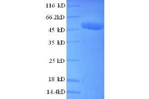 Casein Kinase 2, beta (CSNK2B) (AA 2-215), (partial) protein (GST tag) (CSNK2B Protein (AA 2-215, partial) (GST tag))