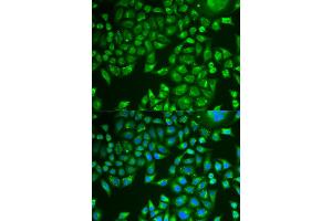 Immunofluorescence analysis of U2OS cells using PNLIP antibody (ABIN5975718). (PNLIP antibody)