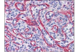 Human Spleen: Formalin-Fixed, Paraffin-Embedded (FFPE) (STAU1/Staufen antibody  (C-Term))