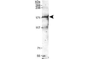 Western blot analysis of Trpm2 in mouse brain membrane lysates with Trpm2 polyclonal antibody . (TRPM2 antibody  (AA 1200-1300))