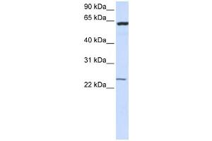 Western Blotting (WB) image for anti-Transmembrane Protein 138 (TMEM138) antibody (ABIN2459085) (TMEM138 antibody)