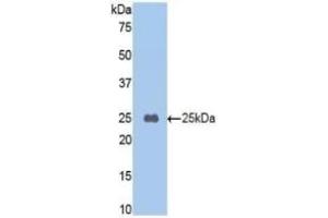 CPB2 antibody  (AA 187-327)