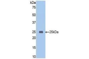 Detection of Recombinant TAFI, Mouse using Polyclonal Antibody to Carboxypeptidase B2 (CPB2) (CPB2 antibody  (AA 187-327))