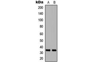 Western blot analysis of Carbonic Anhydrase 8 expression in MCF7 (A), NS-1 (B) whole cell lysates. (CA8 antibody  (Center))