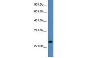 Image no. 1 for anti-Signal Sequence Receptor, beta (Translocon-Associated Protein Beta) (SSR2) (AA 99-148) antibody (ABIN6746258) (SSR2 antibody  (AA 99-148))