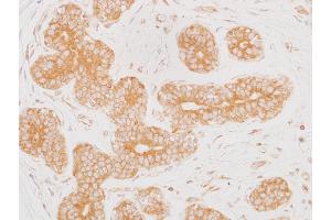 Immunohistochemistry (IHC) image for anti-Mitogen-Activated Protein Kinase Kinase 2 (MAP2K2) (AA 1-50) antibody (ABIN7454013) (Recombinant MEK2 antibody  (AA 1-50))