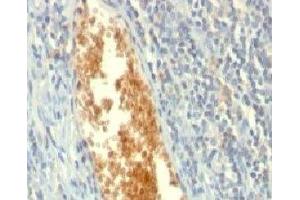 Formalin-fixed, paraffin-embedded human tonsil stained with AMPD3 antibody (AMPD3/901) (AMPD3 antibody)