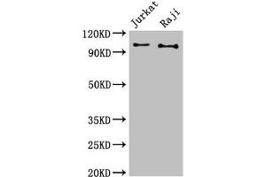 Western Blot Positive WB detected in: Jurkat whole cell lysate, Raji whole cell lysate All lanes: CBL antibody at 3 μg/mL Secondary Goat polyclonal to rabbit IgG at 1/50000 dilution Predicted band size: 100 kDa Observed band size: 100 kDa