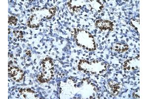 Rabbit Anti-ENO1 Antibody       Paraffin Embedded Tissue:  Human alveolar cell   Cellular Data:  Epithelial cells of renal tubule  Antibody Concentration:   4. (ENO1 antibody  (C-Term))