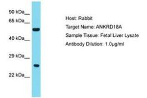 Image no. 1 for anti-Ankyrin Repeat Domain 18A (ANKRD18A) (AA 781-830) antibody (ABIN6750781) (ANKRD18A antibody  (AA 781-830))