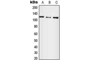 Western blot analysis of UBE4A expression in HepG2 (A), SP2/0 (B), H9C2 (C) whole cell lysates.