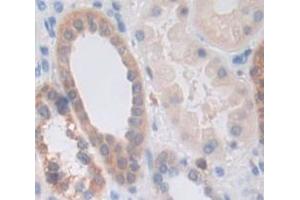 Figure. (IRAK3 antibody  (AA 201-410))