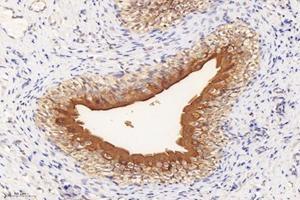 Immunohistochemistry analysis of paraffin-embedded rat bladder using,Uroplakin Ia (ABIN7076160) at dilution of 1: 4000 (UPK1A antibody)