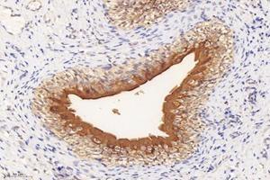 Immunohistochemistry analysis of paraffin-embedded rat bladder using,Uroplakin Ia (ABIN7076160) at dilution of 1: 4000 (UPK1A antibody)