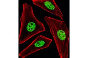 Fluorescent image of Hela cells stained with SP1 Antibody (ABIN1944791 and ABIN2838536). (SP1 antibody  (AA 1-250))