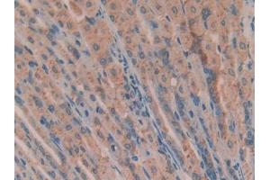 Used in DAB staining on fromalin fixed paraffin- embedded brain tissue (ANG antibody  (AA 25-145))