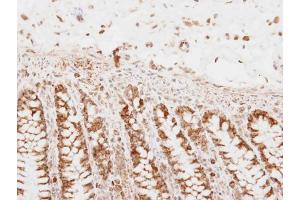 IHC-P Image PNPase antibody detects PNPase protein at mitochondria on human normal colon by immunohistochemical analysis. (PNPT1 antibody)