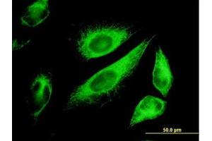 Image no. 5 for anti-Keratin 18 (KRT18) (AA 1-431) antibody (ABIN598778) (Cytokeratin 18 antibody  (AA 1-431))