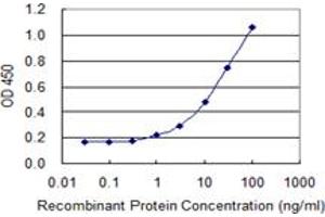 Detection limit for recombinant GST tagged PAGE1 is 0. (PAGE1 antibody  (AA 1-146))