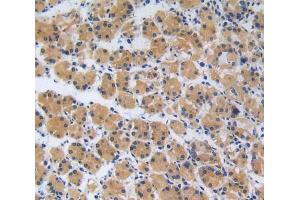 Used in DAB staining on fromalin fixed paraffin- embedded stomach tissue